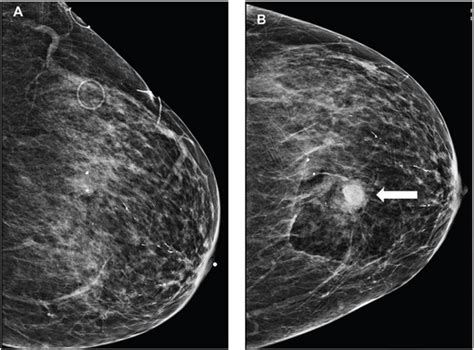 85 Year Old Patient Who Mainta IMAGE EurekAlert Science News Releases