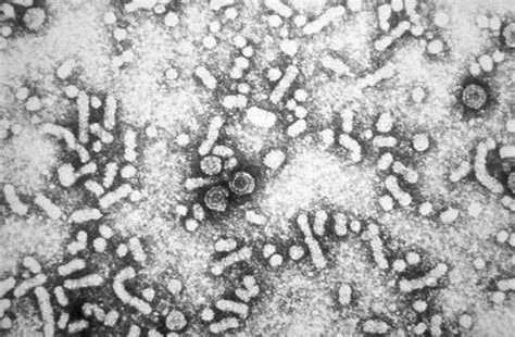 Virus De La Hepatitis B Concise Medical Knowledge