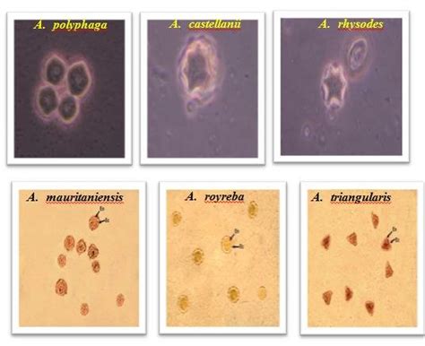 Cyst Stage Of Different Acanthamoeba Isolates From Swimming Pool Water Download Scientific