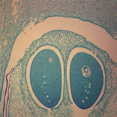 Pine Ovule L S M Egg Nucleus Microscope Slide Carolina