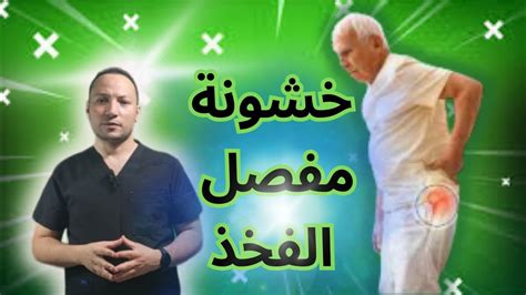 خشونة مفصل الفخذالوركالحوض Youtube