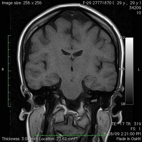 Servicio de Resonancia Magnética Diagnostico Maipú