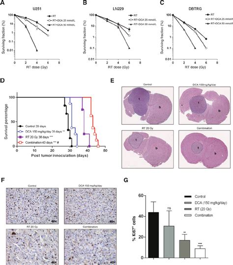 Ef Fi Cacy Of Radiotherapy Rt In Combination With Dichloroacetate