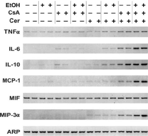 Pancreatic Cytokine And Chemokine MRNA Expression In The CsA Model Of