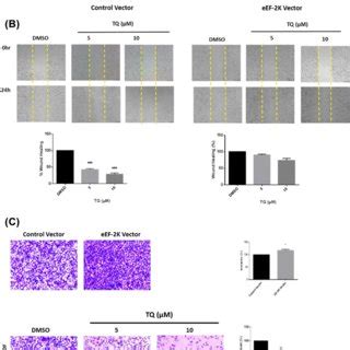 Eukaryotic Elongation Factor Kinase Eef K Overexpression