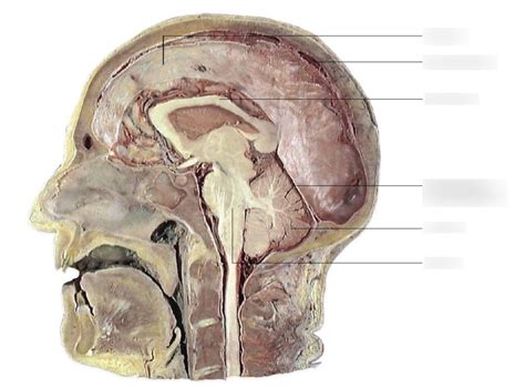 Neuroanatomy Diagram Quizlet