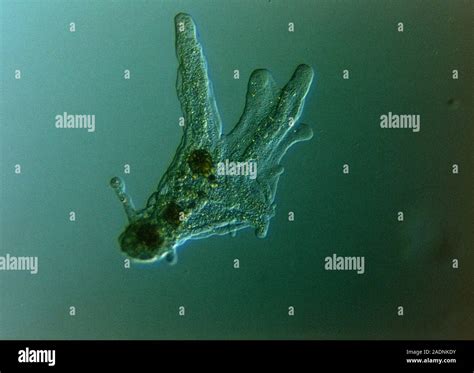 Light Micrograph Of The Protozoa Amoeba Proteus Magnification X27 At