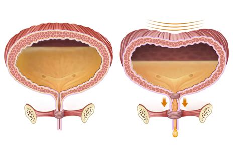 Urologist Singapore | Urohealth Medical Clinic