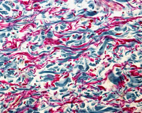 Collagen Fibers Histology Stock Photos, Pictures & Royalty-Free Images ...