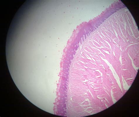 Compact Bone Histology Howmed Images