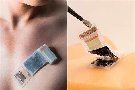 Wireless Wearable Ultrasound Patch Could Be A Game Changer For Real