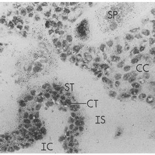 Photomicrograph Of An Autoradiograph Of First Trimester Wk