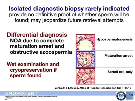 Clinical Management Of Men With Nonobstructive Azoospermia Azoosper