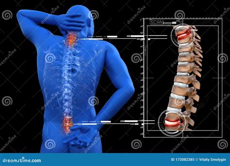 Anatomical Vision Back Pain Spine Anatomy 3d Illustration Stock