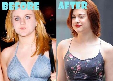 Frances Bean Cobain Plastic Surgery Before And After Photos Lovely Surgery Celebrity Before