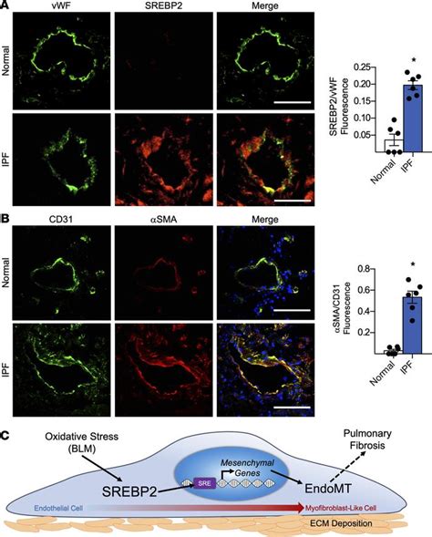 JCI Insight - Role of endothelial cells in pulmonary fibrosis via SREBP2 activation