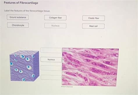 Solved Features of Fibrocartilage Label the features of the | Chegg.com