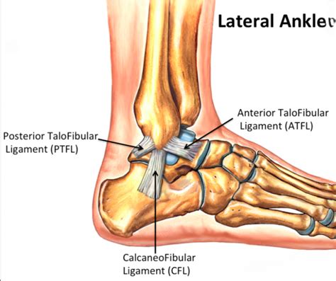 Physical Therapy For Ankle Sprains [infographic] Mangiarelli Rehabilitation