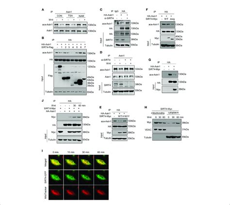 SIRT4 Translocates To The Cytoplasm And Regulates The Acetylation