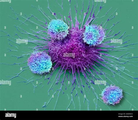 T Zellen Und Lungenkrebs Zelle Composite Farbige Scanning Electron