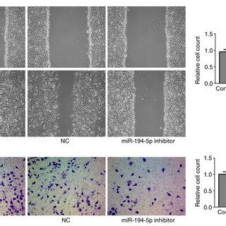 Knockdown Of MiR 194 5p Inhibits The Migration And Invasion Of MCF 7