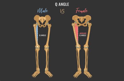 Why Do Women Have A Higher Risk Of Acl Injury