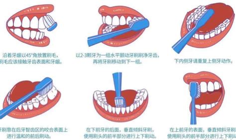 牙疼怎么止痛最快小妙招？在家就可以止痛这五种方法，不再为牙疼烦恼 知乎