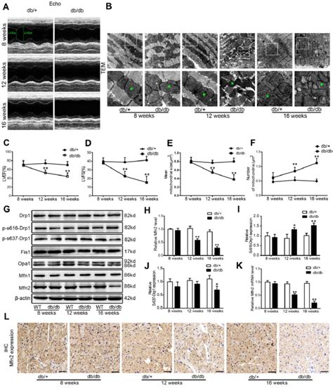 Excessive Mitochondrial Fission And Reduced Mfn2 Expression Were