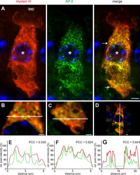 Colocalization Of AP 2 Protein And Myosin VI In Mature P19 IHCs A