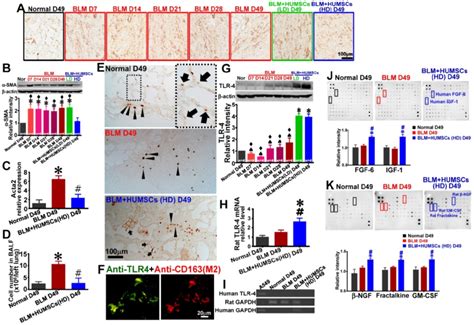 Transplantation Of Humscs Reduced The Activation Of Fibroblasts And