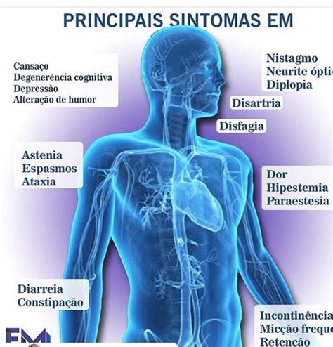 Esclerose Múltipla entenda o porquê da importância de se fazer o