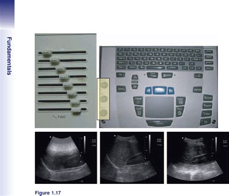 Figure 1 1 From Manual Of Emergency And Critical Care Ultrasound Semantic Scholar