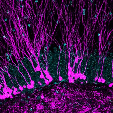 Neurons In The Mouse Hippocamp IMAGE EurekAlert Science News Releases