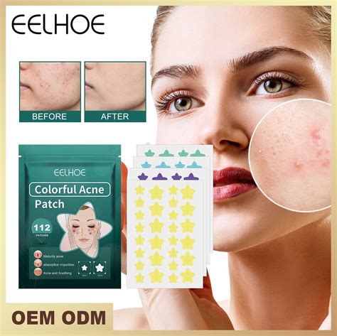 Gzwccvsn Star Acne Pimple Patch 112 Counts Acne Patches For Your Face