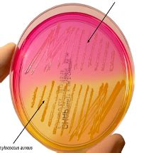 Microlab Final Bacteria Tests Flashcards Quizlet