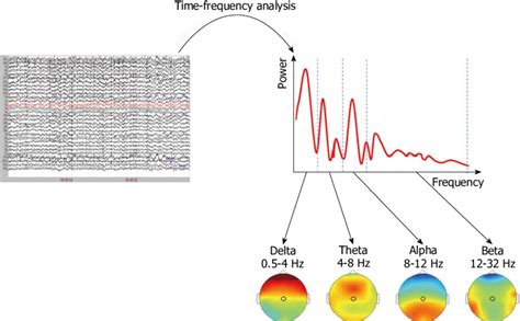 Eeg Spectral Analysis