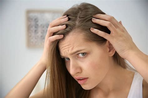 La Alopecia Frontal Fibrosante Causas Y Tratamientos IML