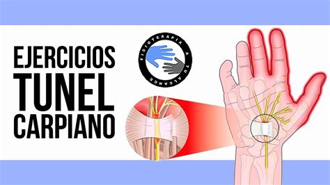 Los Mejores Ejercicios Para El Sindrome Del Tunel Carpiano Youtube