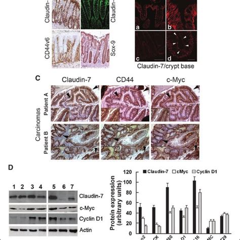 Expression Pattern Of Claudin 7 In Human Colonic Crypts And Colorectal