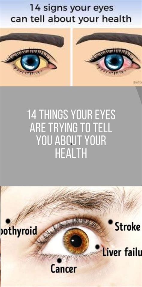 14 Things Your Eyes Are Trying To Tell You About Your Health Natural Health Tips Health