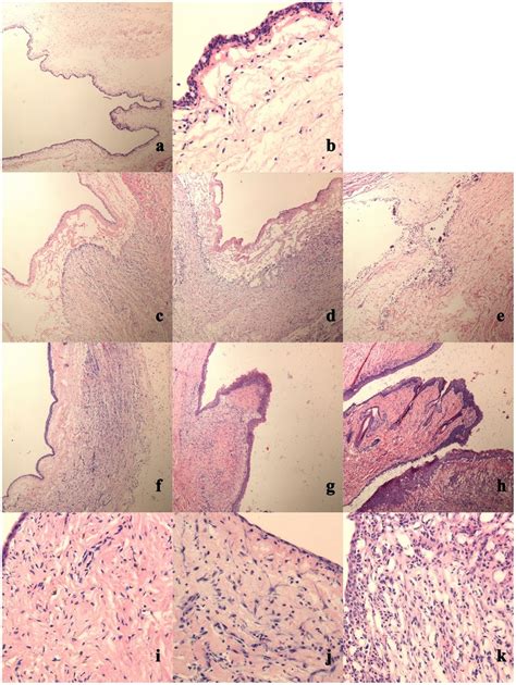 Micrographic Photographs Of Haematoxylin Eosin Staining At Follow Up Download Scientific