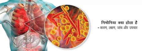 निमोनिया: लक्षण, उपचार विकल्प, और रोकथाम सुझाव