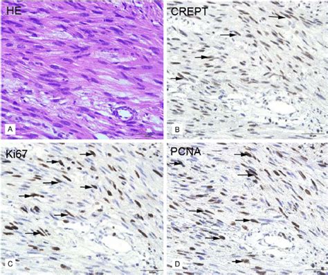 Representative Results Of The H E And Immunohistochemical Staining For