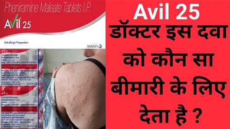 Avil 25 Tablet Uses In Hindi Side Effect Precaution YouTube