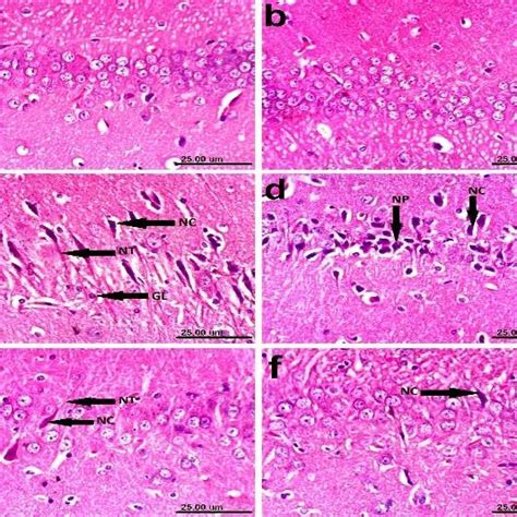 Photomicrographs Of H E Stained Sections Of CA1 Region Of The