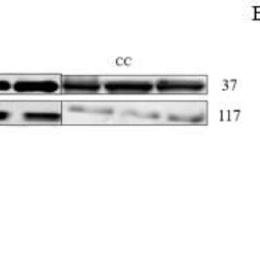 A ACE Protein Expression Levels With G 5066812A C Different