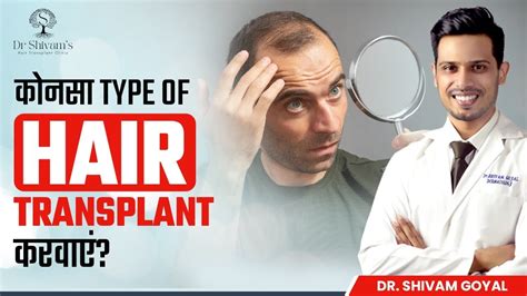 🤔कोनसा Hair Transplant ज्यादा Results देगा Different Types Of Hair Transplant Dr Shivam