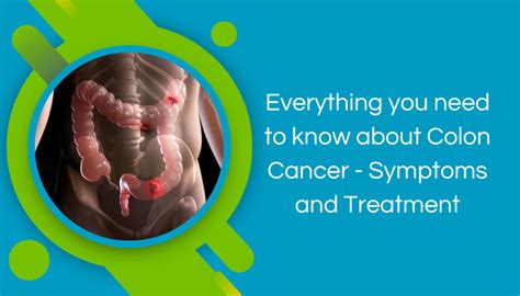 Everything You Need To Know About Colon Cancer — Symptoms And Treatment