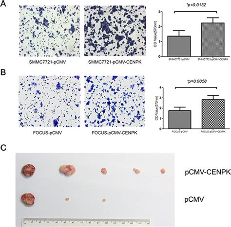 Overexpression Of Centromere Protein K Cenp K Gene In Hepatocellular