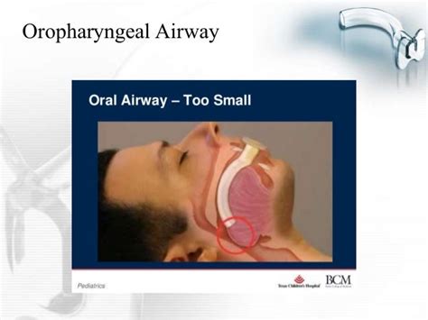 Oropharyngeal Airway Device